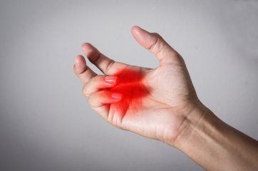 Как избавиться от ожога на пальце